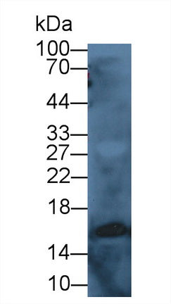 DAB staining on IHC-P; Samples: Human Liver Tissue;  Primary Ab: 30µg/ml Mouse Anti-Human CST3 Antib