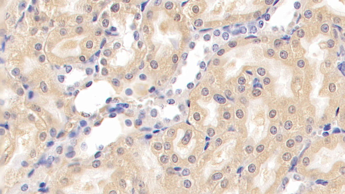Nephrin (NPHN) Monoclonal Antibody - image 3