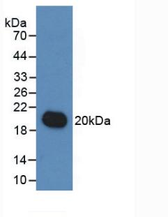 Western Blot; Sample: Rat Liver lysate; ; Primary Ab: 3µg/ml Mouse Anti-Human IL19 Antibody; Second Ab: 0.2µg/mL HRP-Linked Caprine Anti-Mouse IgG Polyclonal Antibody;