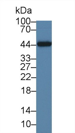 DAB staining on IHC-P; Samples: Human Cerebrum Tissue;  Primary Ab: 30μg/ml Mouse Anti-Human IL19 Antibody Second Ab: 2µg/mL HRP-Linked Caprine Anti-Mouse IgG Polyclonal Antibody