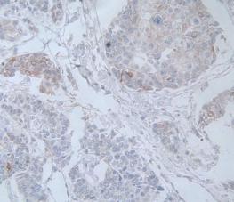 Interleukin 19 (IL19) Monoclonal Antibody - image 5