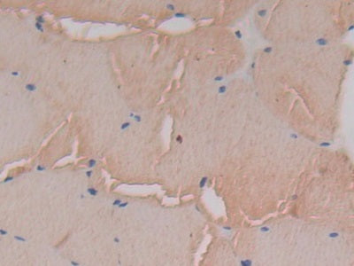 DAB staining on IHC-P; Samples: Rat Skeletal muscle Tissue)