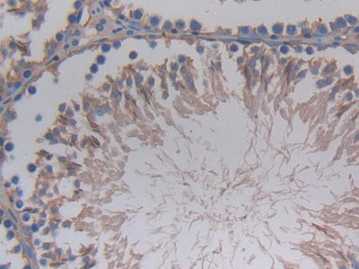 Corticosteroid Binding Globulin (CBG) Monoclonal Antibody - image 4