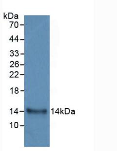 DAB staining on IHC-P; Samples: Human Glioma Tissue; Primary Ab: 20µg/ml Mouse Anti-Human IL33 Antibody Second Ab: 2µg/mL HRP-Linked Caprine Anti-Mouse IgG Polyclonal Antibody
