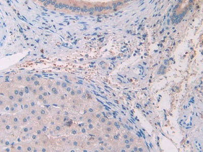Interleukin 33 (IL33) Monoclonal Antibody - image 5