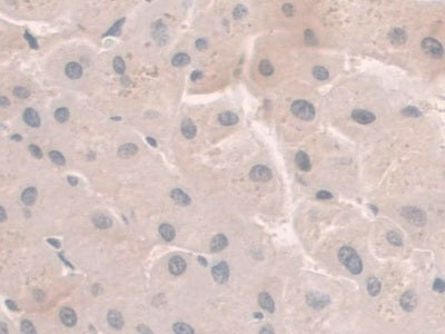 Hemojuvelin (HJV) Monoclonal Antibody - image 5