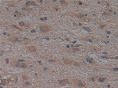 Noggin (NOG) Monoclonal Antibody - image 5