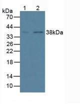 Knockout Varification: <br/>Lane 1: Wild-type Hela cell lysate; <br/>Lane 2: ANXA1 knockout Hela cell lysate; <br/>Predicted MW: 39kDa <br/>Observed MW: 39kDa<br/>Primary Ab: 2µg/ml Mouse Anti-Human ANXA1 Antibody<br/>Second Ab: 0.2µg/mL HRP-Linked Caprine Anti-Mouse IgG Polyclonal Antibody<br/>