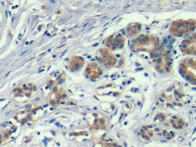 DAB staining on IHC-P; Samples: Human Stomach Tissue; Primary Ab: 10µg/ml Mouse Anti-Human ANXA1 Antibody Second Ab: 2µg/mL HRP-Linked Caprine Anti-Mouse IgG Polyclonal Antibody