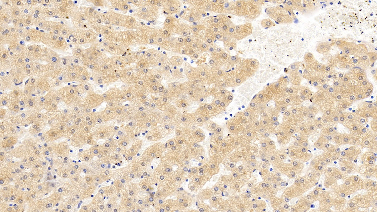 Angiogenin (ANG) Monoclonal Antibody - image 3