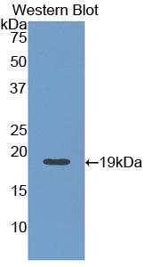 Angiopoietin 1 (ANGPT1) Monoclonal Antibody - image 2