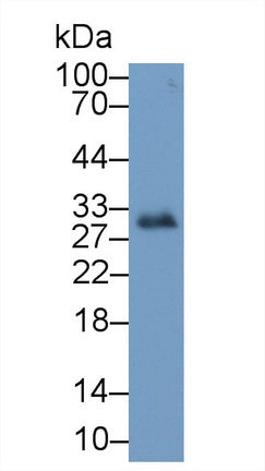 DAB staining on IHC-P; Samples: Human Stomach Tissue;  Primary Ab: 10µg/ml Mouse Anti-Human IGFBP1 Antibody Second Ab: 2µg/mL HRP-Linked Caprine Anti-Mouse IgG Polyclonal Antibody