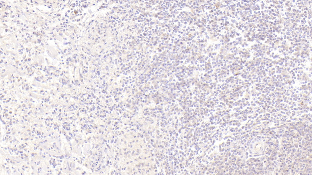 Insulin Like Growth Factor Binding Protein 1 (IGFBP1) Monoclonal Antibody - image 4