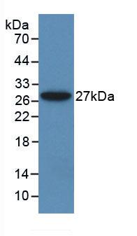 Alanine Aminotransferase (ALT) Monoclonal Antibody - image 2