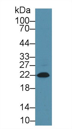 Western Blot; Sample: Lane1: Human Serum; Lane2: Rat Heart Tissue.