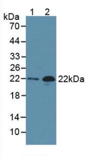 N-Terminal Pro-Brain Natriuretic Peptide (NT-ProBNP) Monoclonal Antibody - image 3