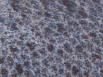 DAB staining on IHC-P; Samples: Rat Liver Tissue.