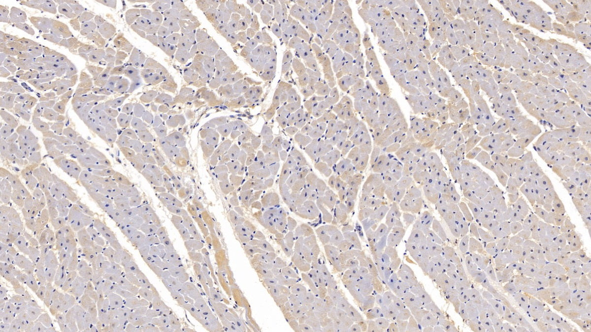 DAB staining on IHC-P; Samples: Human Stomach Tissue;  Primary Ab: 10µg/ml Mouse Anti-Human HIF1a Antibody Second Ab: 2µg/mL HRP-Linked Caprine Anti-Mouse IgG Polyclonal Antibody