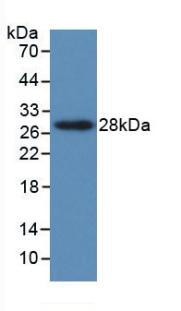 Parathyroid Hormone Related Protein (PTHrP) Monoclonal Antibody - image 2