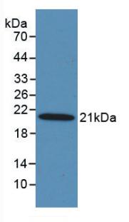Western Blot; Sample: Lane1: Human Serum; Lane2: Human Urine; Primary Ab: 5μg/ml Mouse Anti-Human MASP2 Antibody; Second Ab: 0.2µg/mL HRP-Linked Caprine Anti-Mouse IgG Polyclonal Antibody;