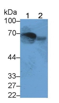 Mannose Associated Serine Protease 2 (MASP2) Monoclonal Antibody - image 3