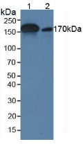 Western Blot; Sample: Human Serum; ; Primary Ab: 5µg/ml Mouse Anti-Human a2M Antibody; Second Ab: 0.2µg/mL HRP-Linked Caprine Anti-Mouse IgG Polyclonal Antibody;