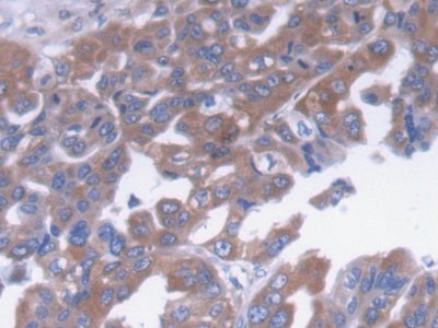 Alpha-2-Macroglobulin (a2M) Monoclonal Antibody - image 5