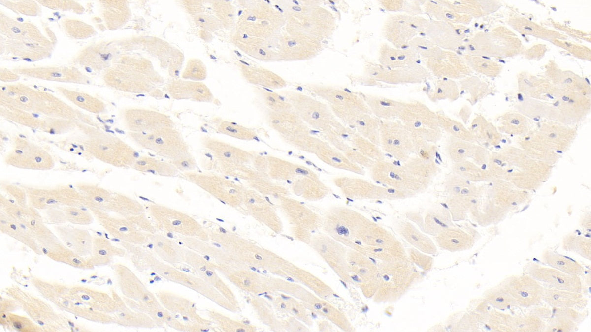 DAB staining on IHC-P; Samples: Human Liver Tissue; Primary Ab: 30µg/ml Mouse Anti-Human ALB Antibody Second Ab: 2µg/mL HRP-Linked Caprine Anti-Mouse IgG Polyclonal Antibody
