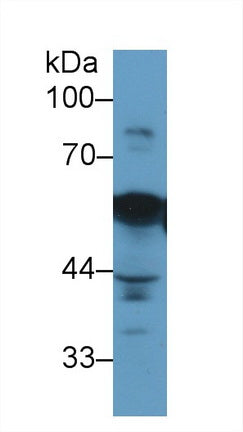 DAB staining on IHC-P; Samples: Human Prostate Tissue; Primary Ab: 10µg/ml Mouse Anti-Human VIM Antibody Second Ab: 2µg/mL HRP-Linked Caprine Anti-Mouse IgG Polyclonal Antibody