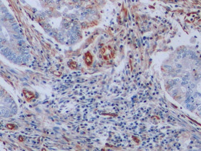 Vimentin (VIM) Monoclonal Antibody - image 5