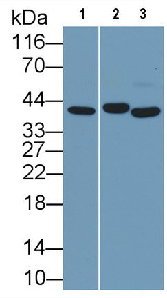 Arginase (ARG) Monoclonal Antibody - image 2