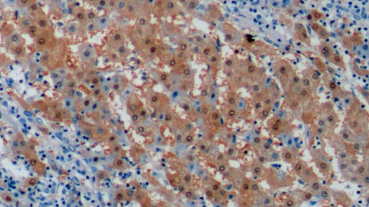 DAB staining on IHC-P; Samples: Human Liver Tissue;  Primary Ab: 10µg/ml Mouse Anti-Human Arg Antibody Second Ab: 2µg/mL HRP-Linked Caprine Anti-Mouse IgG Polyclonal Antibody