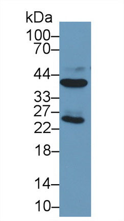 DAB staining on IHC-P; Samples: Human Liver Tissue; Primary Ab: 20µg/ml Mouse Anti-Human ARG Antibody Second Ab: 2µg/mL HRP-Linked Caprine Anti-Mouse IgG Polyclonal Antibody