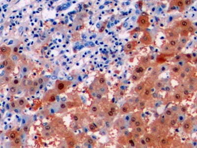 Arginase (ARG) Monoclonal Antibody - image 5
