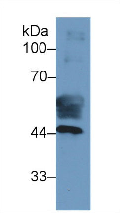 Cytokeratin 19 (CK19) Monoclonal Antibody - image 2