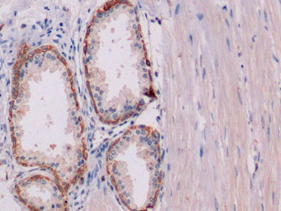 DAB staining on IHC-P; Samples: Human Liver Tissue; Primary Ab: 10µg/ml Mouse Anti-Human KRT19 Antibody Second Ab: 2µg/mL HRP-Linked Caprine Anti-Mouse IgG Polyclonal Antibody