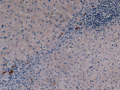 Cytokeratin 19 (CK19) Monoclonal Antibody - image 4