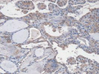 Vascular Endothelial Growth Factor 121 (VEGF121) Monoclonal Antibody - image 4