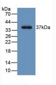 DAB staining on IHC-P; Samples: Human Liver Tissue;  Primary Ab: 20µg/ml Mouse Anti-Human LRG1 Antibody Second Ab: 2µg/mL HRP-Linked Caprine Anti-Mouse IgG Polyclonal Antibody