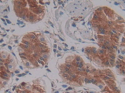DAB staining on IHC-P; Samples: Human Stomach Tissue)