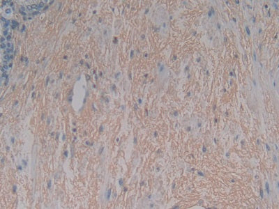 Left/Right Determination Factor 1 (LEFTY1) Monoclonal Antibody - image 3