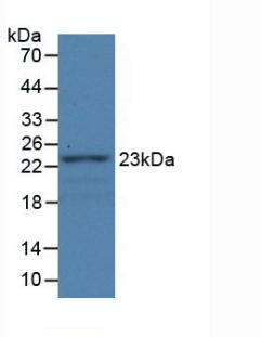 Fibulin 1 (FBLN1) Monoclonal Antibody - image 2