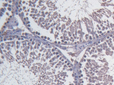 Fibulin 1 (FBLN1) Monoclonal Antibody - image 3