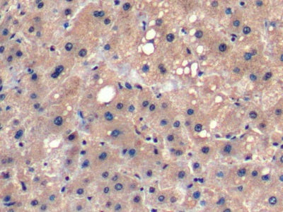 Fibroblast Growth Factor 21 (FGF21) Monoclonal Antibody - image 4