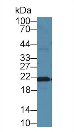 Western Blot; Sample: Recombinant FTH, Mouse.