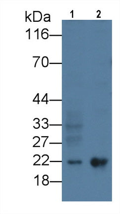 DAB staining on IHC-P; Samples: Mouse Kidney Tissue; Primary Ab: 20µg/ml Mouse Anti-Mouse FTH Antibody Second Ab: 2µg/mL HRP-Linked Caprine Anti-Mouse IgG Polyclonal Antibody