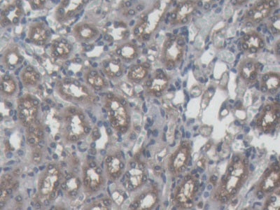 DAB staining on IHC-P; Samples: Mouse Liver Tissue; Primary Ab: 20µg/ml Mouse Anti-Mouse FTH Antibody Second Ab: 2µg/mL HRP-Linked Caprine Anti-Mouse IgG Polyclonal Antibody