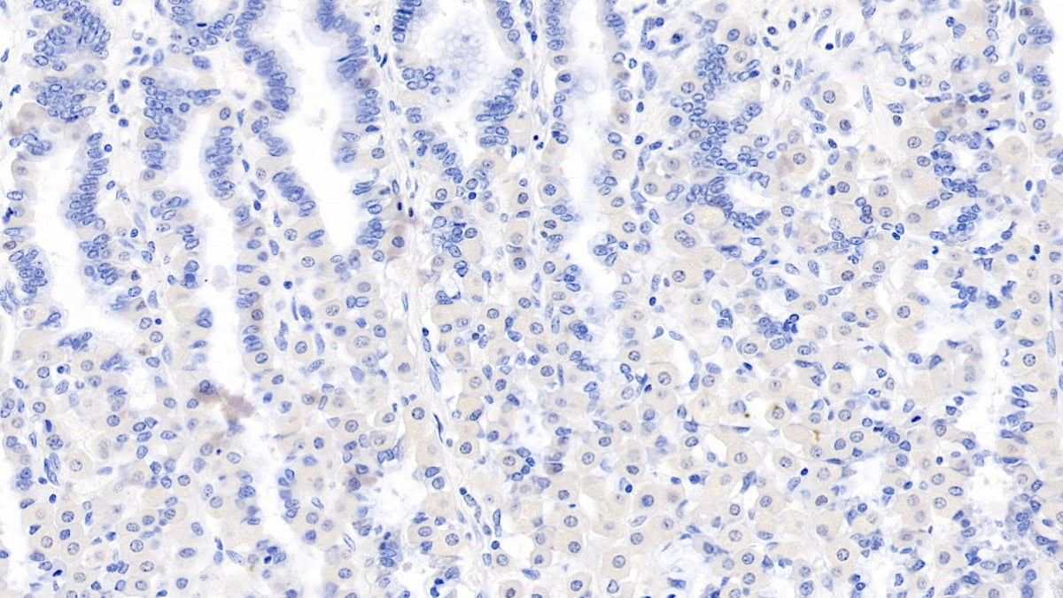 DAB staining on IHC-P; Samples: Human Liver Tissue;  Primary Ab: 10µg/ml Mouse Anti-Human LSR Antibody Second Ab: 2µg/mL HRP-Linked Caprine Anti-Mouse IgG Polyclonal Antibody