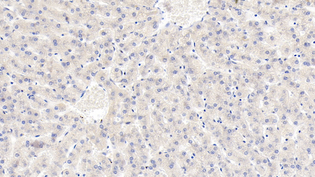 Lipolysis Stimulated Lipoprotein Receptor (LSR) Monoclonal Antibody - image 5