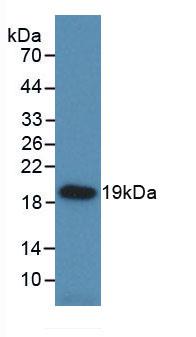 DAB staining on IHC-P; Samples: Rat Heart Tissue;  Primary Ab: 40µg/ml Mouse Anti-Rat HSPb6 Antibody Second Ab: 2µg/mL HRP-Linked Caprine Anti-Mouse IgG Polyclonal Antibody